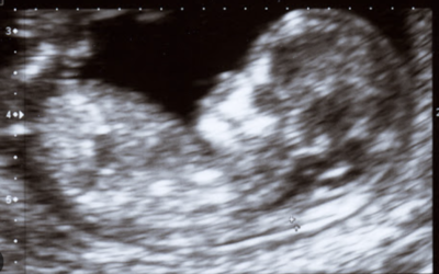 Jesus In The Womb: Month 7